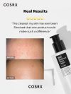 COSRX BHA Blackhead Liquid - Korean Skincare