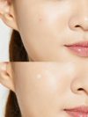 COSRX Pimple Patch - Korean Skincare