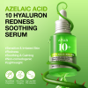 Anua Azelaic Acid Serum - Korean Skincare