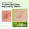 Anua Azelaic Acid Serum - Korean Skincare
