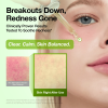 Anua Azelaic Acid Serum - Korean Skincare