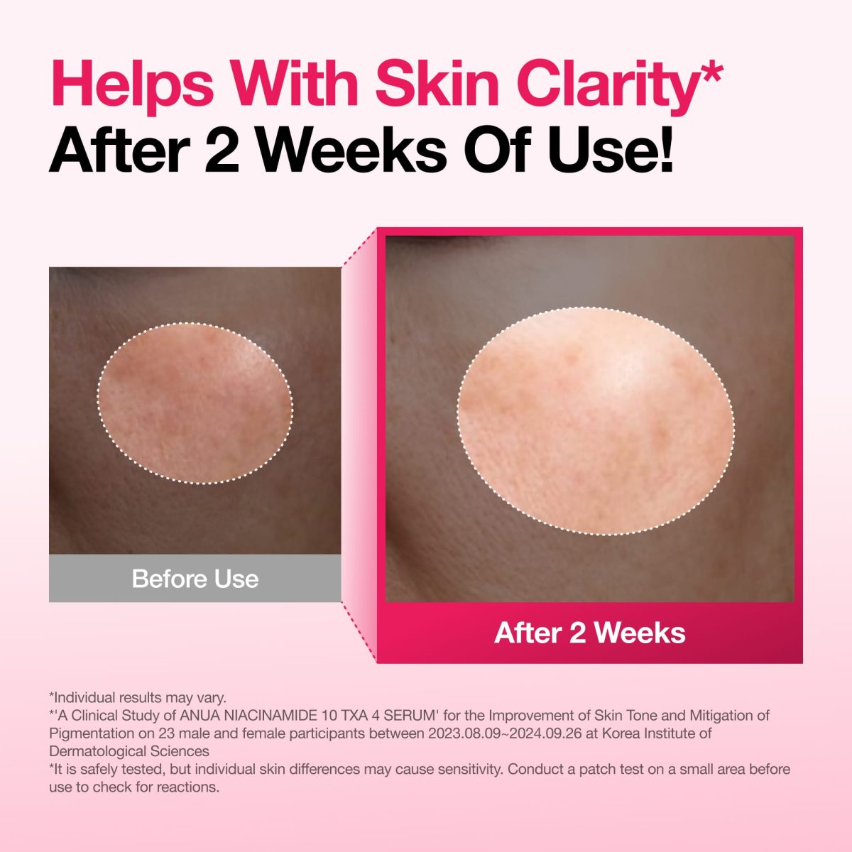 Niacinamide TXA Serum