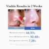 Medicube Zero Pore Pad - Korean Skincare