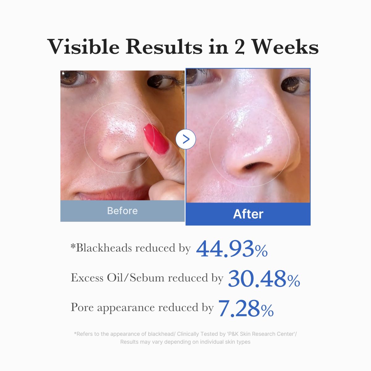 Zero Pore Pad