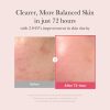 Medicube TXA Niacinamide Serum - Korean Skincare