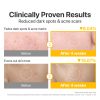 numbuzin No.5 Pads - Korean Skincare