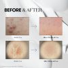 VT Cosmetics Reedle Shot 100 - Korean Skincare