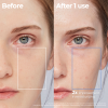 Aestura Atobarrier Lotion - Korean Skincare