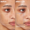 Aestura Atobarrier Mist - Korean Skincare
