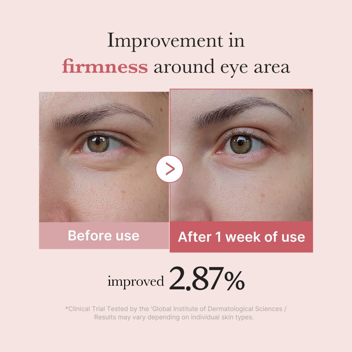 PDRN Pink Peptide Eye Cream 30ml